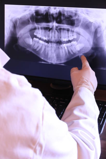Best Emergency Wisdom Teeth Removal in Bountiful, UT