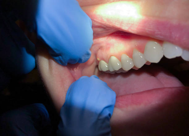 Best Walk-In Emergency Dentist in Bountiful, UT